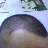 發(fā)際線用戶圖片