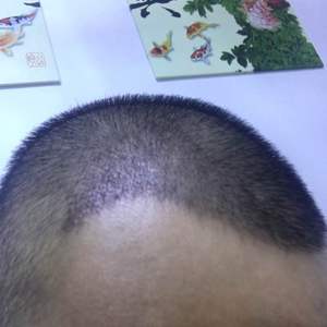 发际线分享社区