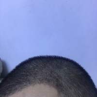 發(fā)際線用戶圖片