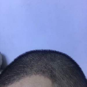 发际线分享社区