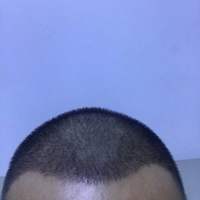 發(fā)際線用戶圖片