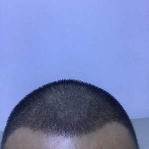 发际线分享社区