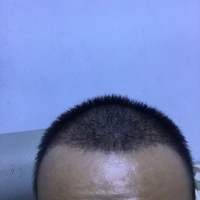 發(fā)際線用戶圖片