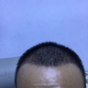 发际线分享社区