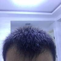 發(fā)際線用戶圖片