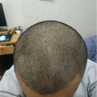 發(fā)際線用戶圖片