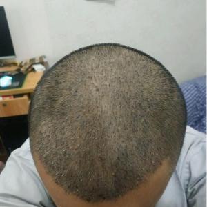 发际线分享社区