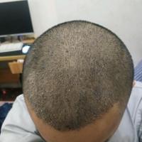 發(fā)際線用戶圖片