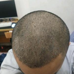 发际线分享社区