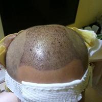 禿頂用戶圖片
