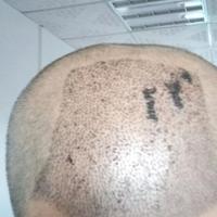 發(fā)際線用戶圖片