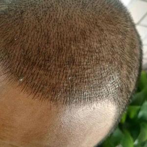 发际线分享社区