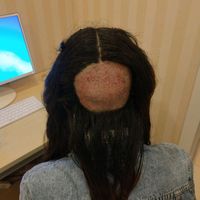 發(fā)際線用戶圖片