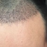 發(fā)際線用戶圖片