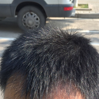 發(fā)際線用戶圖片