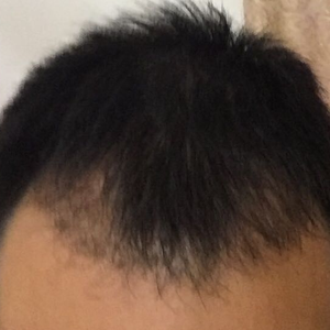 发际线分享社区