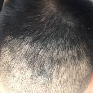 发际线分享社区