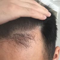 發(fā)際線用戶圖片