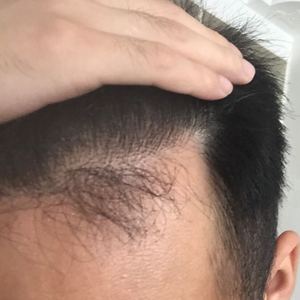 发际线分享社区