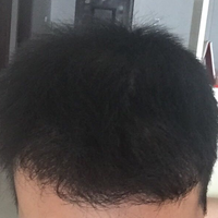 發(fā)際線用戶圖片