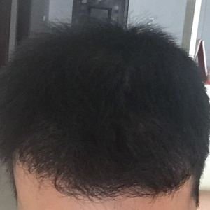 发际线分享社区