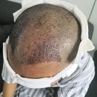 發(fā)際線用戶圖片