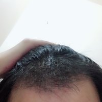 發(fā)際線用戶圖片