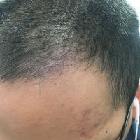 發(fā)際線用戶圖片