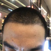 發(fā)際線用戶圖片