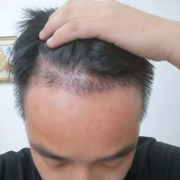 發(fā)際線用戶圖片