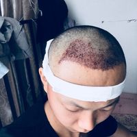 發(fā)際線用戶圖片
