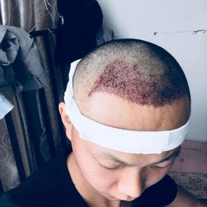 发际线分享社区