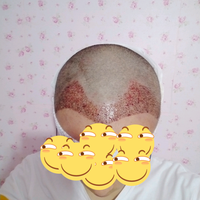 發(fā)際線用戶圖片