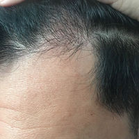 發(fā)際線用戶圖片