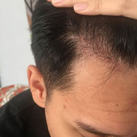 發(fā)際線用戶圖片
