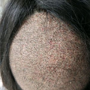 发际线分享社区