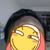 發(fā)際線用戶圖片