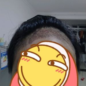 发际线分享社区