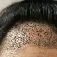 發(fā)際線用戶圖片