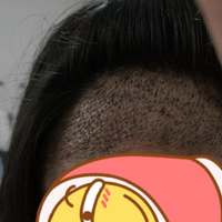 發(fā)際線用戶圖片