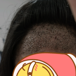 发际线分享社区
