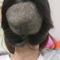 發(fā)際線用戶圖片