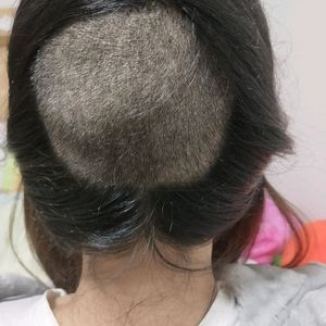 发际线分享社区