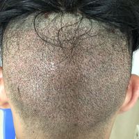 發(fā)際線用戶圖片