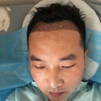 發(fā)際線用戶圖片