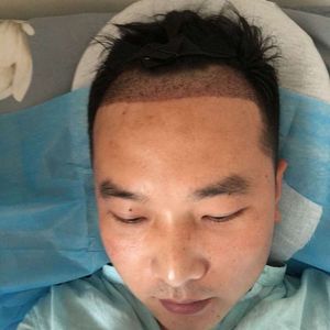 发际线分享社区