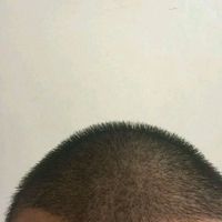 發(fā)際線用戶圖片
