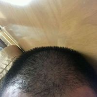 發(fā)際線用戶圖片