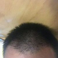 發(fā)際線用戶圖片