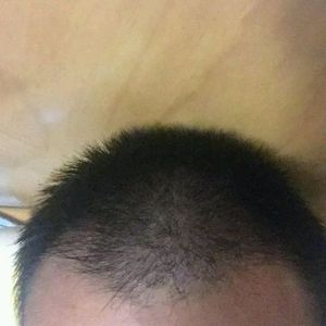 发际线分享社区